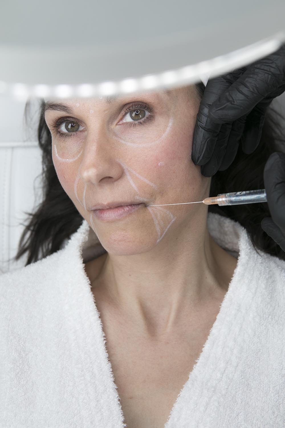 Acide hyaluronique : soins anti-âge pour le visage, médecine anti-âge à Bordeaux