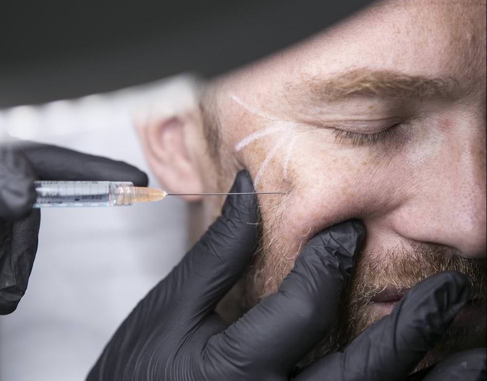 injection botox bordeaux