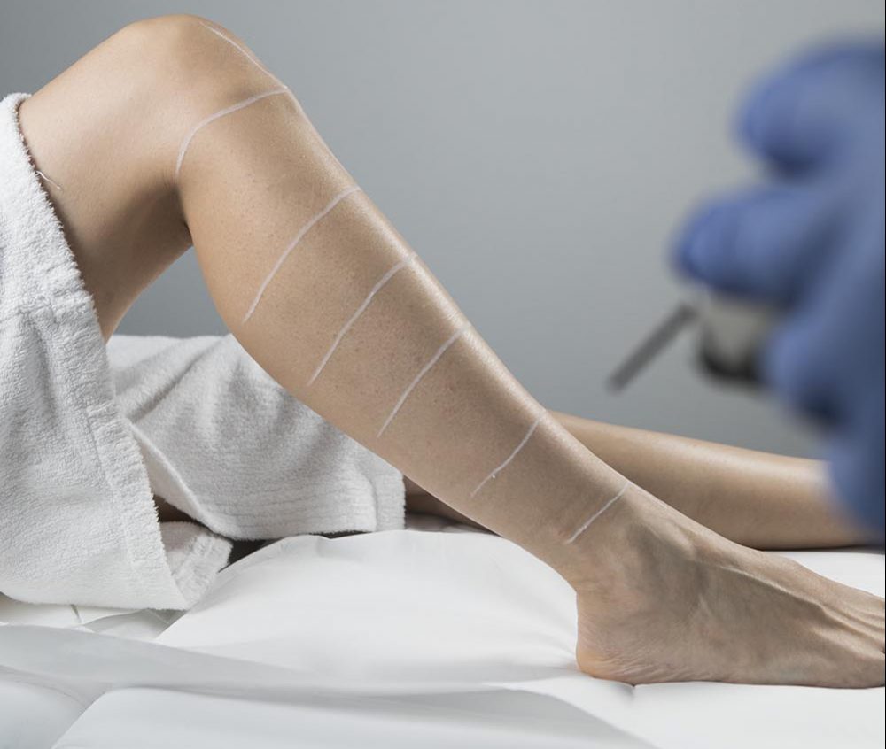 centre epilation laser bordeaux