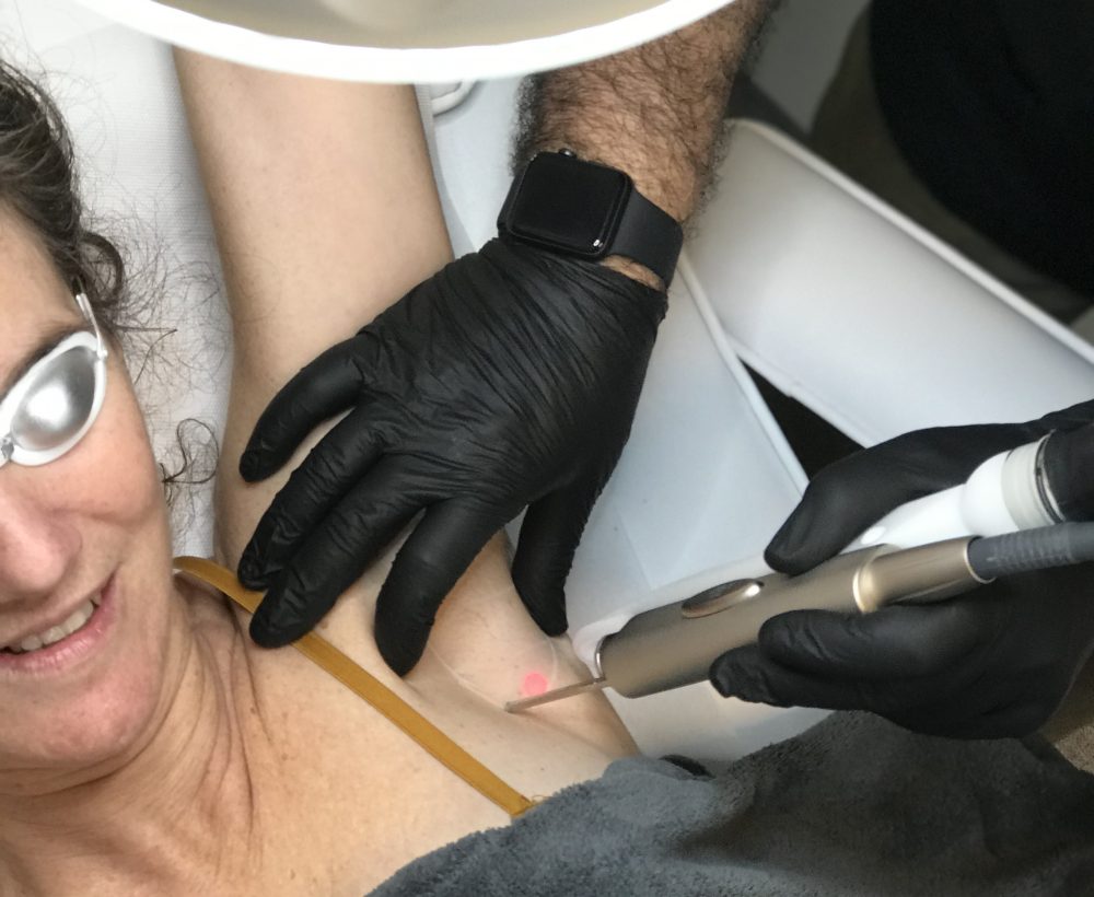 Centre d'épilation définitive au laser visage et corps pour tous types de peau à Bordeaux